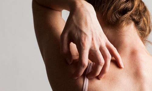 Causas De Los Problemas De La Piel Relacionados Con La Diabetes