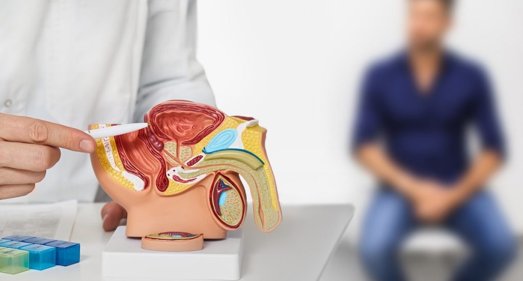 Cáncer De Próstata