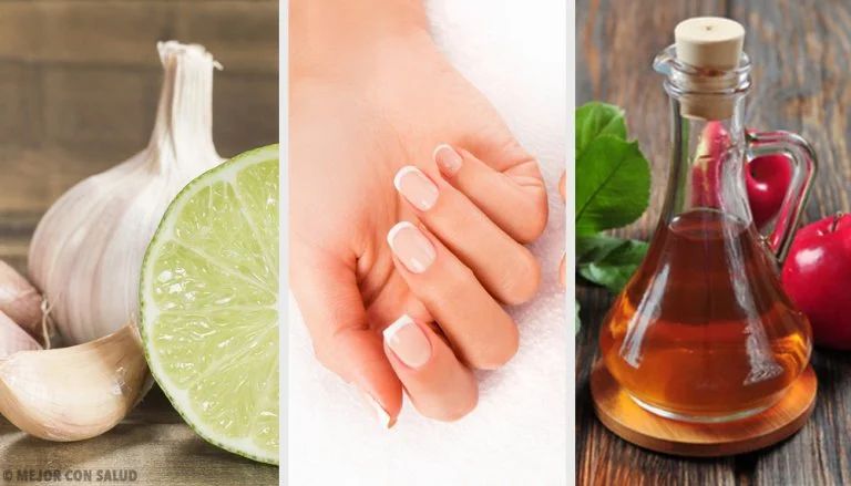 Recomendaciones naturales para el cuidado de las uñas