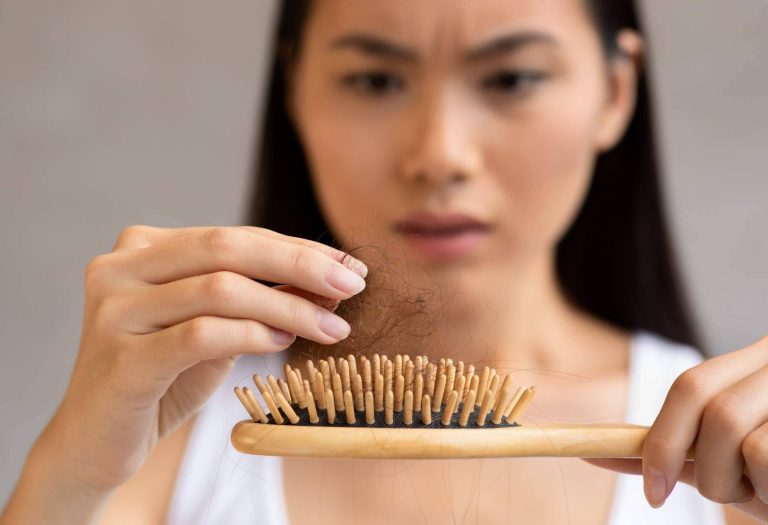 Los tipos más comunes de alopecia femenina y cómo se tratan