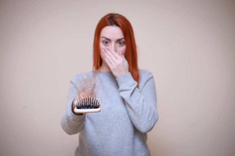 El efluvio telógeno, una alopecia 100 % reversible (si se trata)