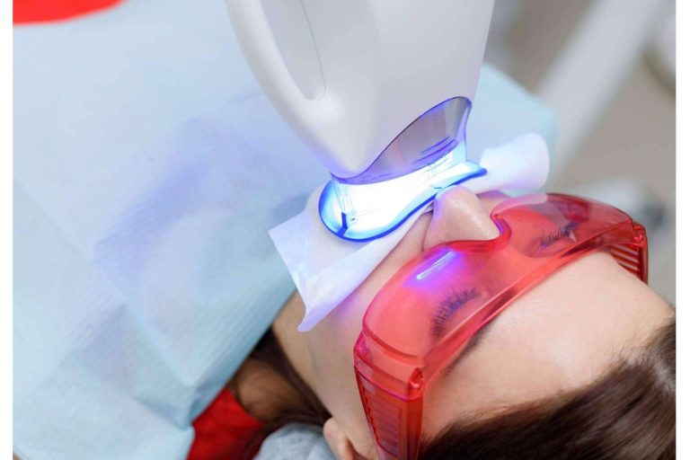 Clínica Dental Delgado indica cómo se realiza un blanqueamiento dental