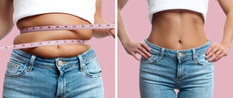 Todo lo que debes saber sobre la celulitis (y cómo evitarla)