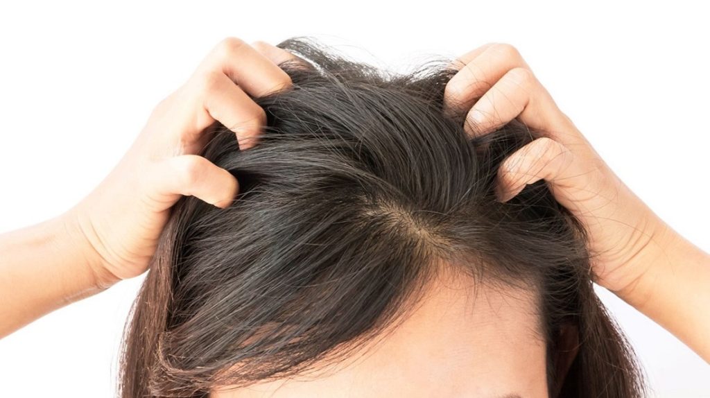 Picor En El Pelo