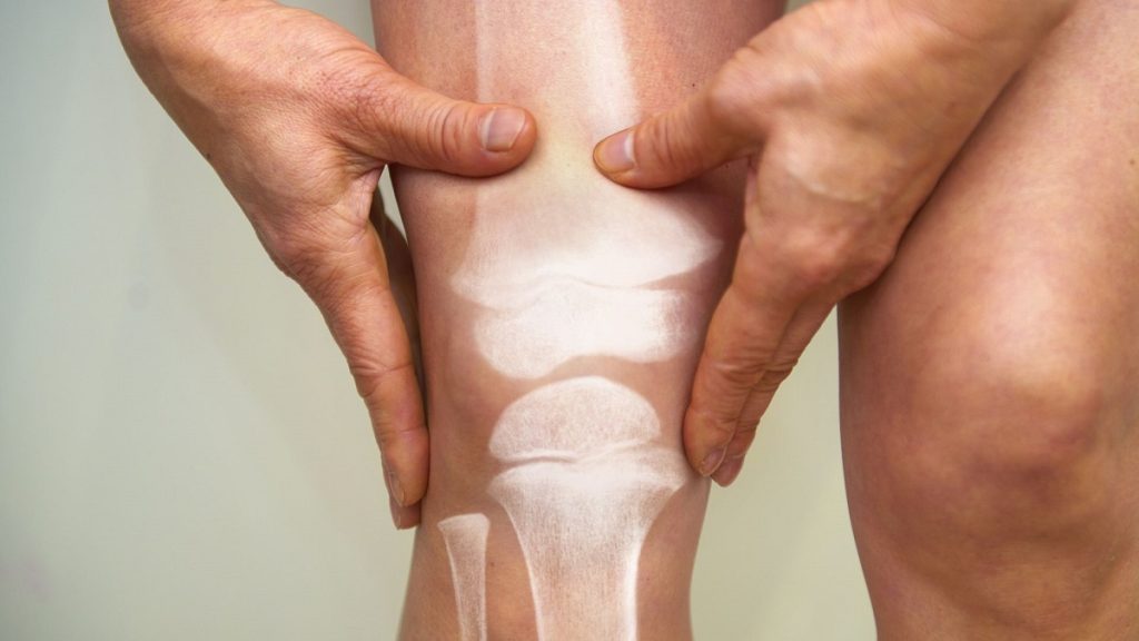 Estos Son Los Motivos Por Los Que Te Duele La Rodilla