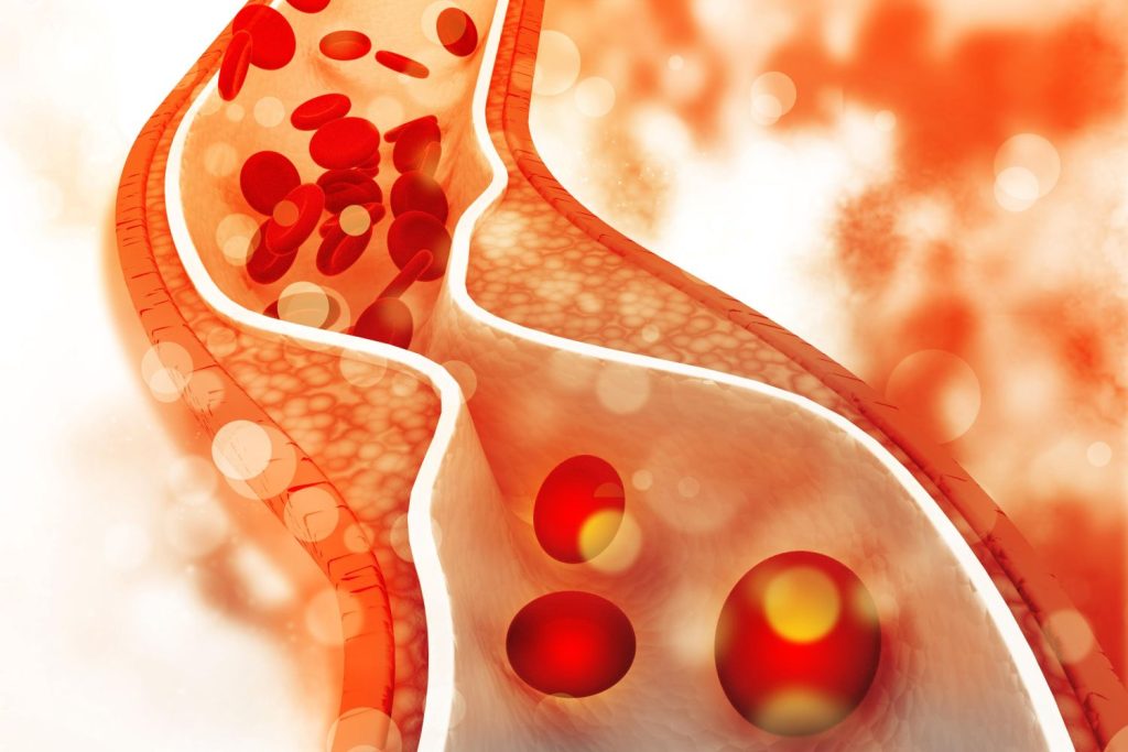 Cuál Es La Importancia Del Colesterol En La Salud