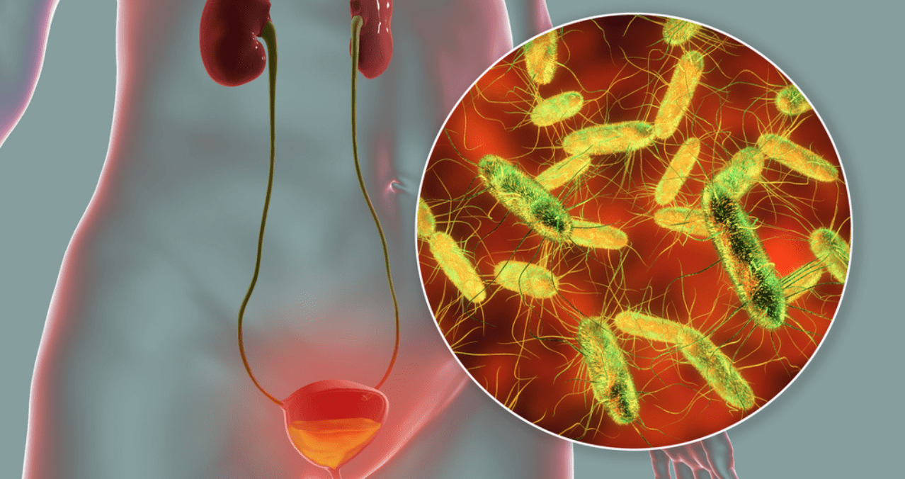 Presencia de bacterias en el torrente sanguíneo