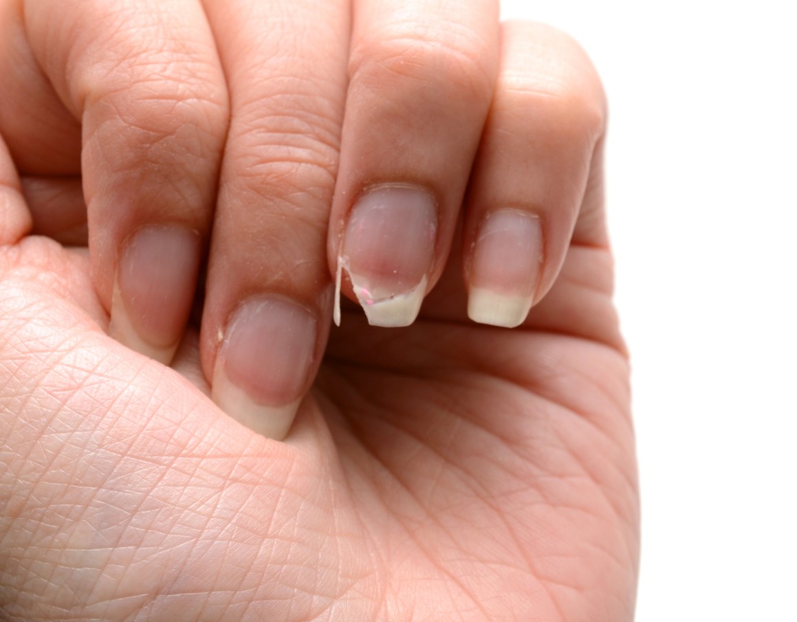 Tus Uñas Se Hacen Más Débiles 