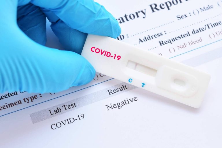 La importancia de haber utilizado el test covid para las fiestas, de la mano de Centro Médico Bravo