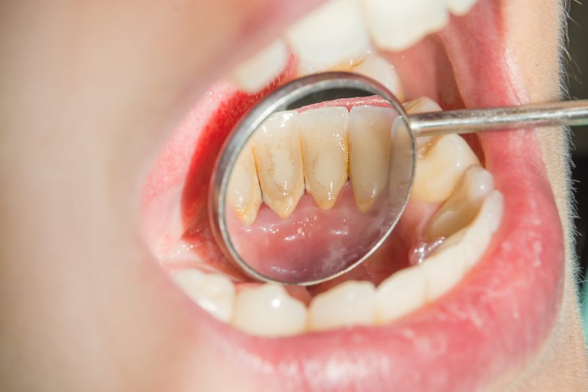 Eritritol, Analizamos Si El Edulcorante Sin Calorías Es Saludable 