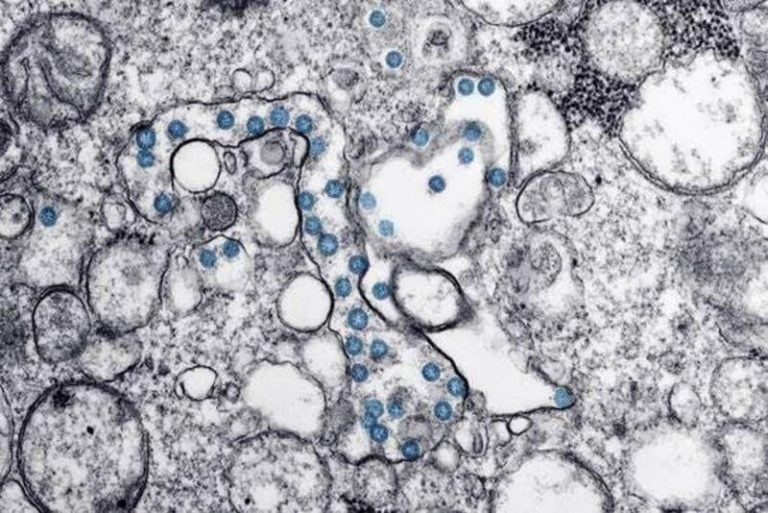 Investigadores del CSIC observan la implicación del envejecimiento celular en los efectos del Covid-19