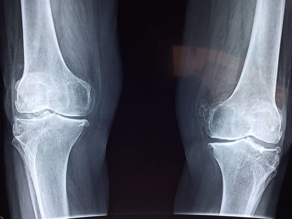 El Inesperado Uso Médico De Los Mocos Que Entusiasma A Los Científicos