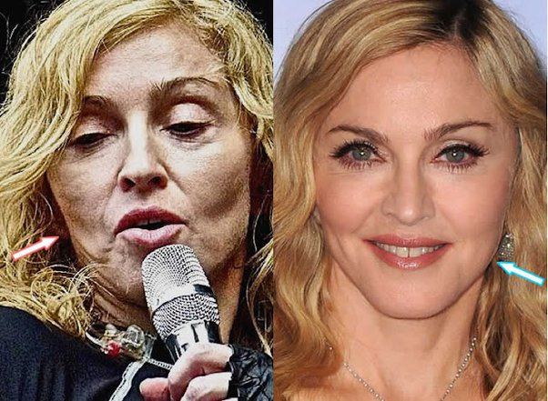 Madonna Responde A Las Críticas Sobre Su Aspecto