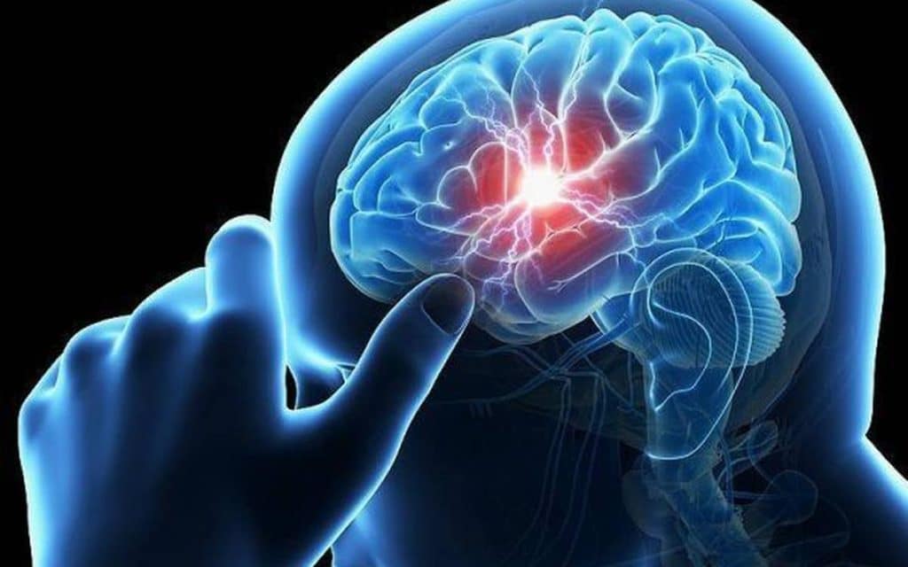 Enfermedad Vascular Cerebral