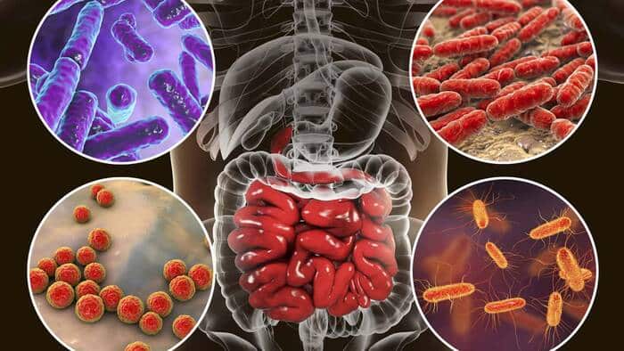 La Famosa Que Sufre De Disbiosis Intestinal