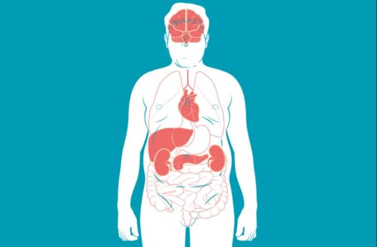Qué es el síndrome metabólico