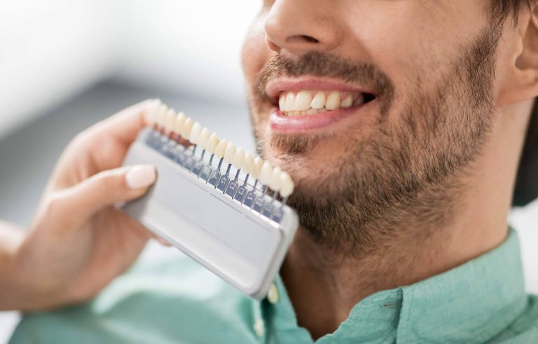 Mejorar la sonrisa de los pacientes con carillas dentales, Clínica Dental Delgado