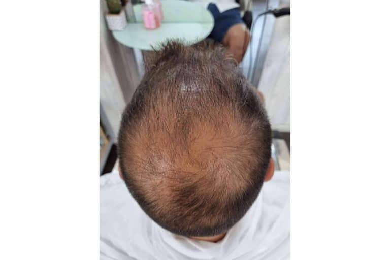 Lion Hair, ¿qué son las fibras capilares?