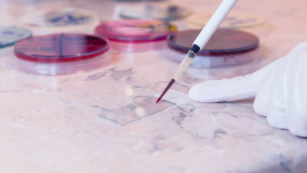 La Pastilla Que Puede Acabar Con Un Tipo De Cáncer Y Entusiasma A Los Médicos