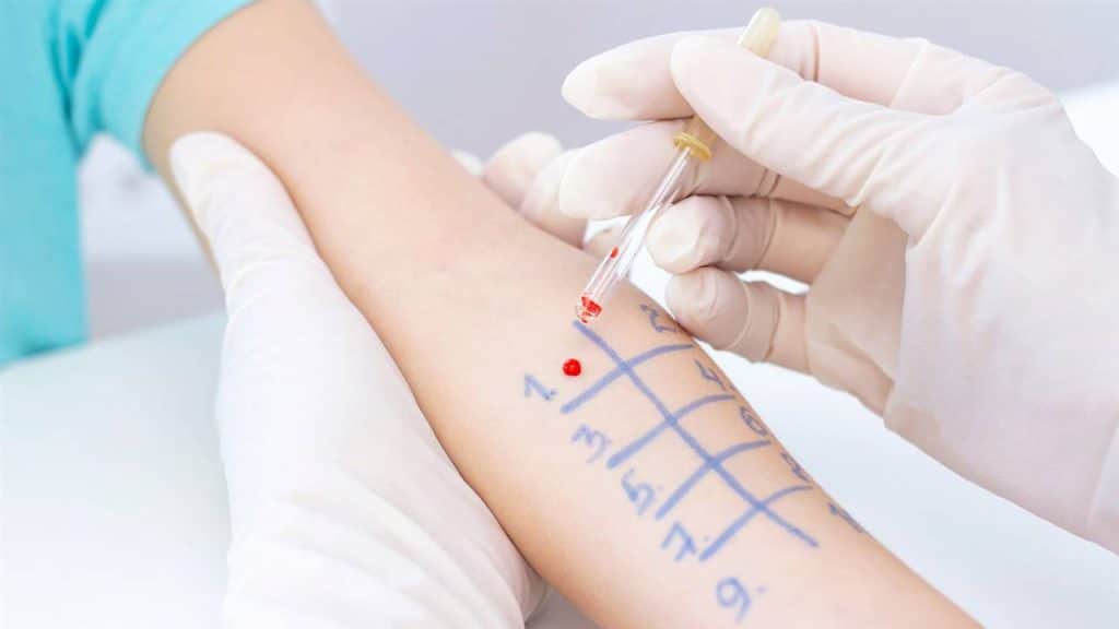 Cómo Saber Si Tus Síntomas Primaverales Son De Alergia
