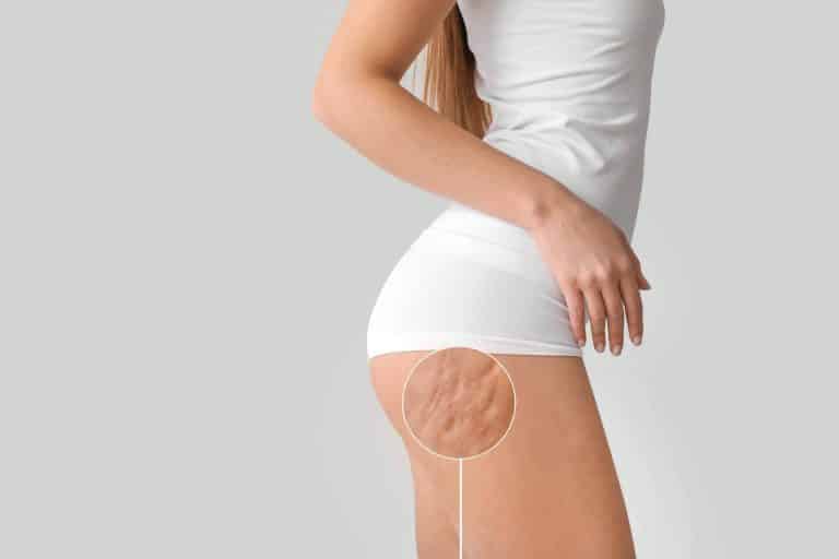 El tratamiento corporal para reducir la celulitis, Vacuslim 48, disponible en Mesmerie