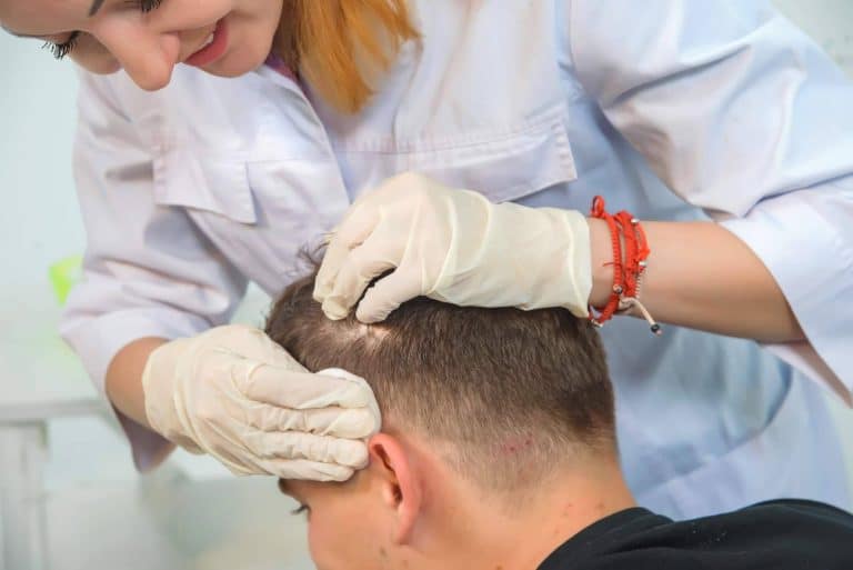 Qué es la CIR cirugia reconstructiva de Capilar Innovation Clinic