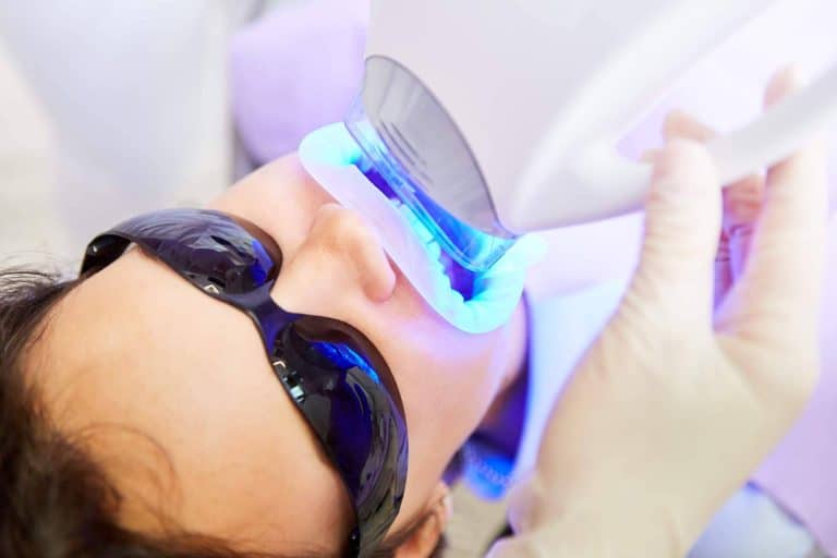 ¿Cómo cuidar los dientes después de un blanqueamiento dental?