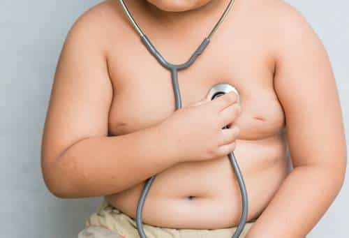 La Obesidad Podría Llegar A Ser Hereditaria