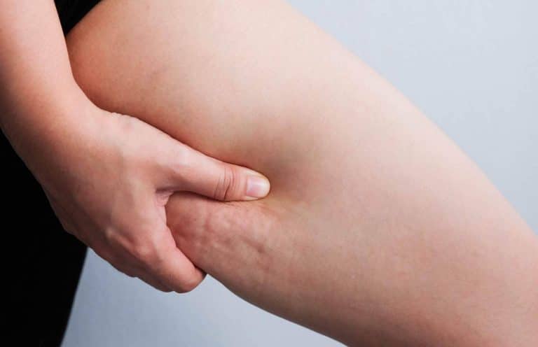 Vacuslim 48, tratamiento corporal para tratar y reducir la celulitis ¿Realmente funciona?