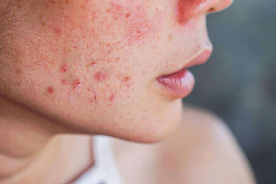 Envejecimiento y cambios hormonales