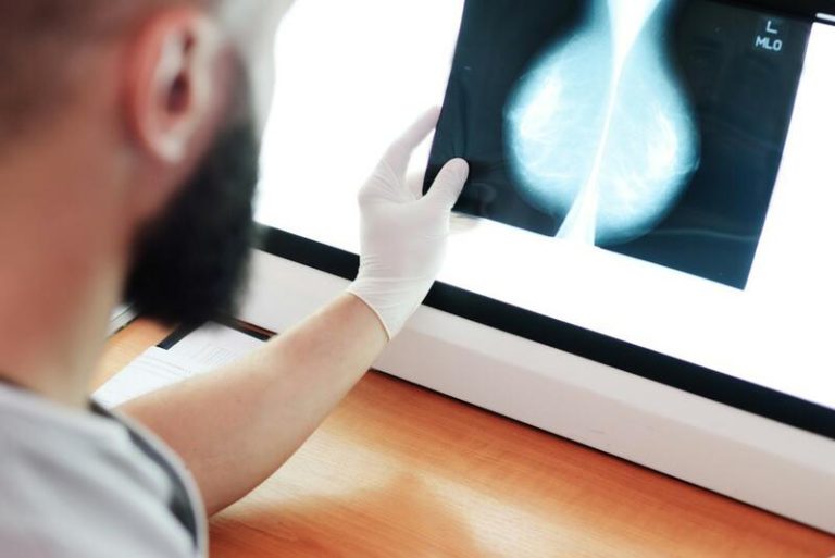 Un total de 47 hospitales españoles prueban con éxito una terapia para el cáncer de mama