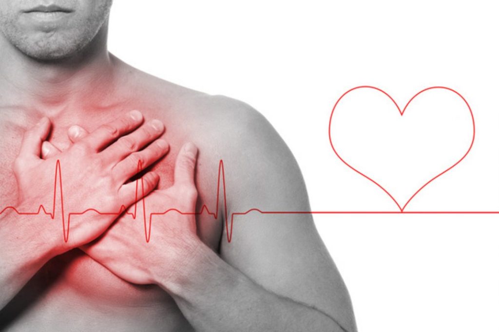 Problemas Cardiovasculares