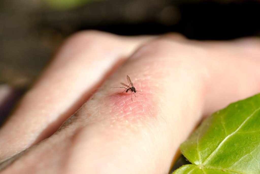 ¿Por Qué Hay Personas Más Propensas A Ser Picadas Por Mosquitos Que Otras?