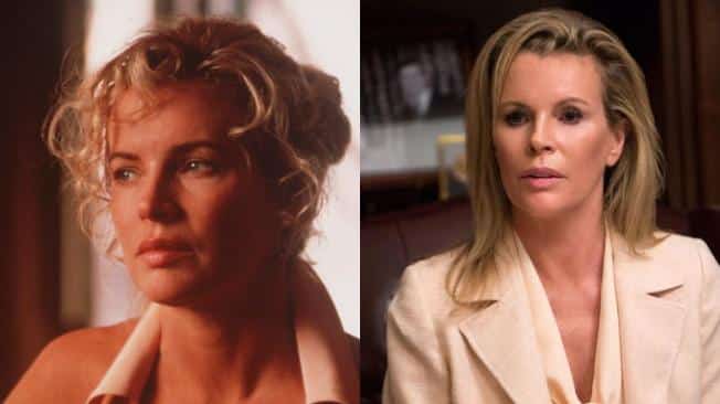 Meg Ryan Y Otros Famosos Irreconocibles Tras Hacerse Una Cirugía