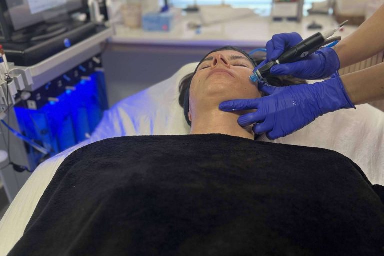 Llega a Oviedo el tratamiento estrella Hydrofacial, de la mano de la Clínica Sánchez del Río