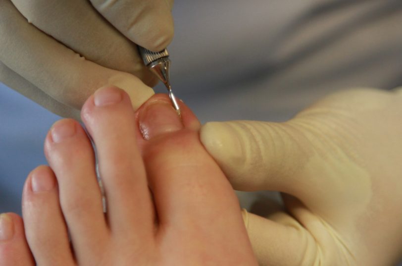 6 Consejos Infalibles Para Preparar Tus Pies Para El Buen Tiempo
