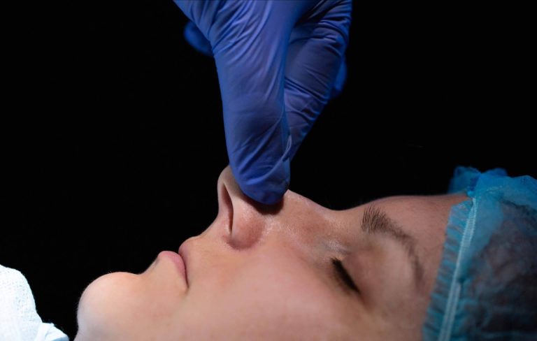 Dr. Julián Castillo corrige los defectos de la nariz con una rinoplastia