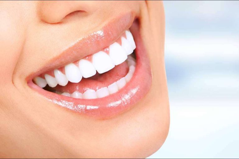 ¿De qué trata la cirugía de sonrisa gingival?