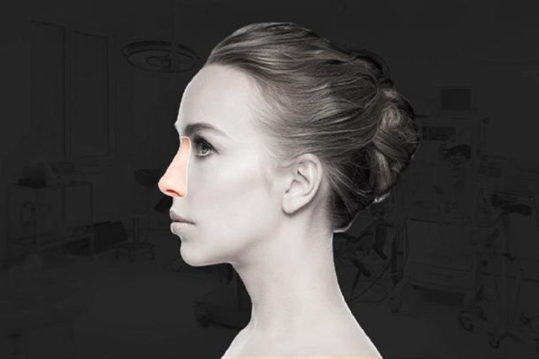 Beneficios de la rinoplastia: estética y salud