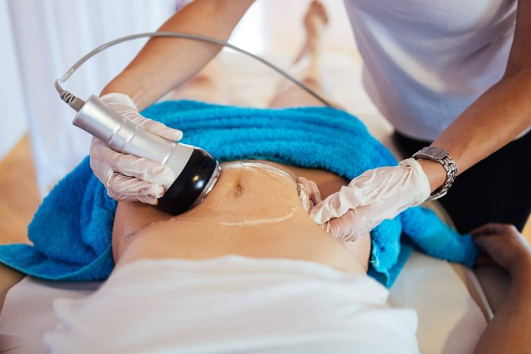 Las características principales del tratamiento de radiofrecuencia corporal, de la mano del Centro Médico El Pilar
