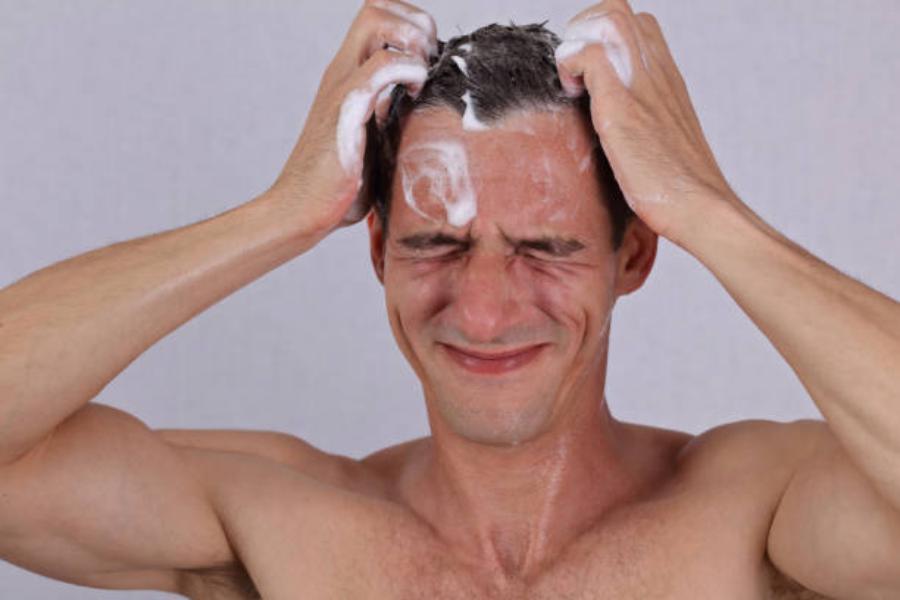 Causas De La Caída Del Cabello