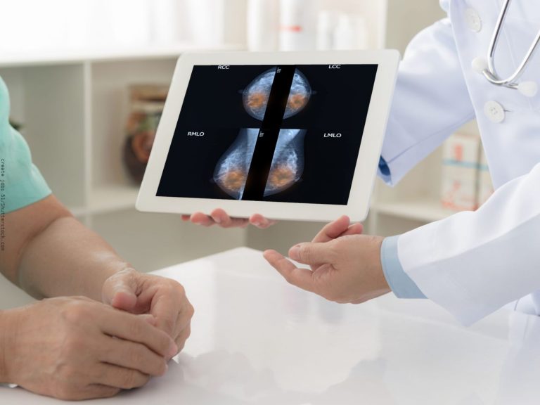 Cómo reducir el riesgo de cáncer: 5 recomendaciones de los científicos