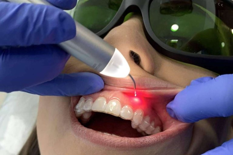 Estética dental con las últimas tecnologías, por Dental Implantologie