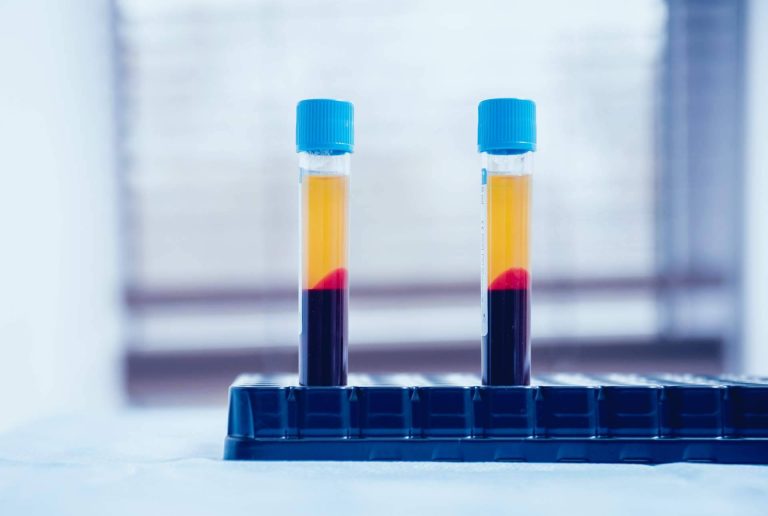 La relevancia del plasma rico en plaquetas en la traumatología