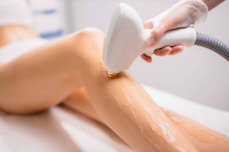 Eliminar arañas vasculares de la mano de Centro Estética El Pilar
