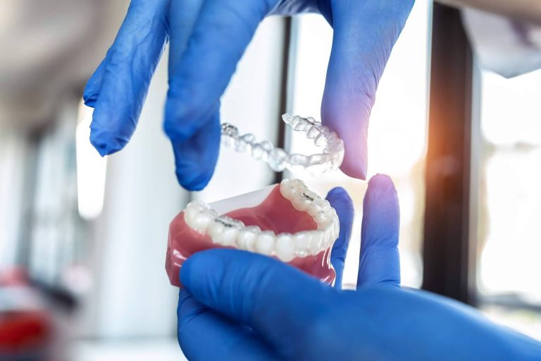 Lola Escalante Estudio Dental, la clínica dental de ortodoncia invisible