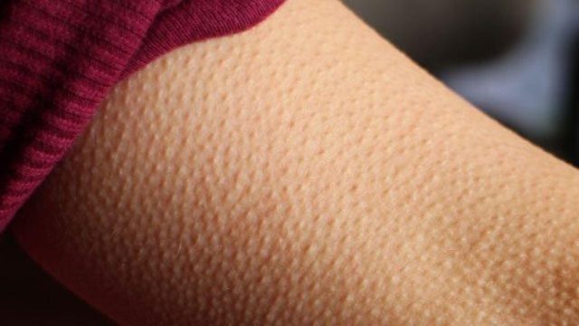 La ‘Piel De Gallina’ No Es Casual: Un Médico Explica Por Qué Aparece Con Canciones O Frío Y Qué Revela De Nuestro Pasado