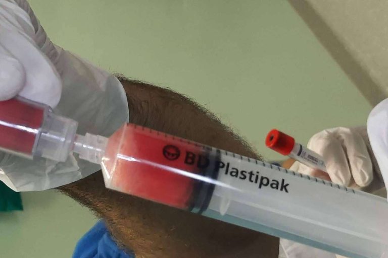 Un tratamiento eficaz sin cirugía para artrosis de rodilla, las infiltraciones de plasma rico en plaquetas y células madre