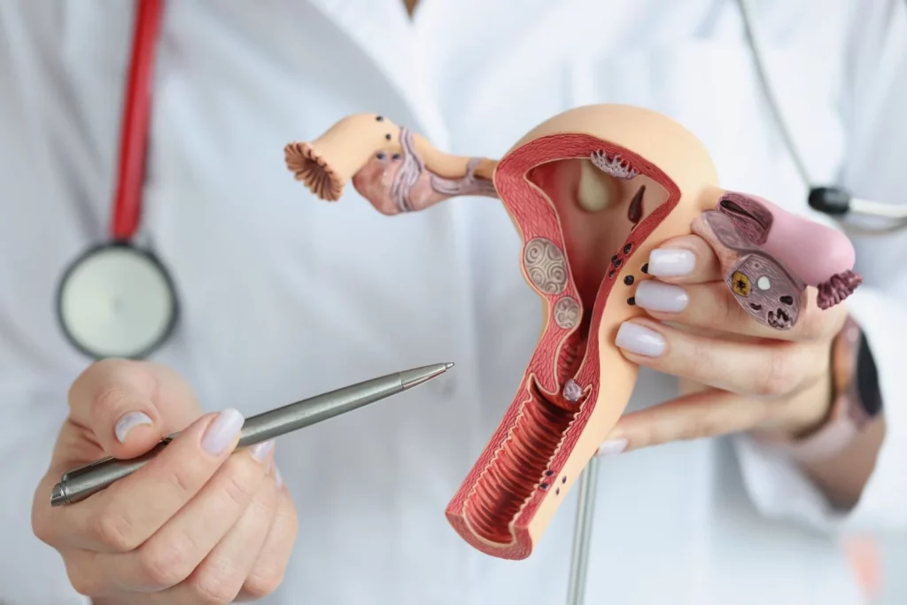 Estadísticas 2024: El Panorama Del Cáncer De Ovario En España