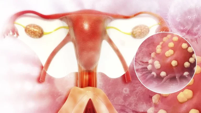 La investigación avanzada frena la mortalidad del cáncer de ovario